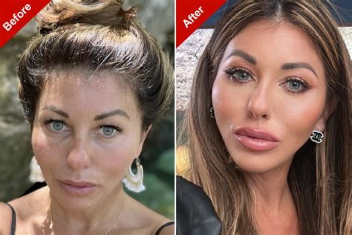 Ana De Armas | Get Her Nose Done? Plastic Surgery Before