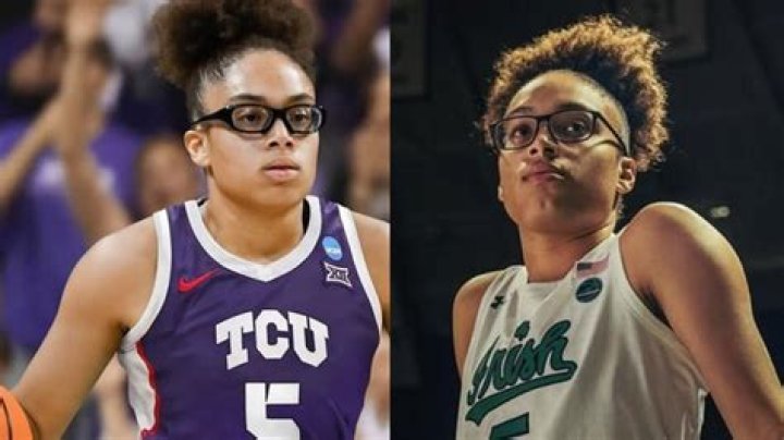 What Happened To Olivia Miles Notre Dame Tooth? Find Her Face Photos On Instagram